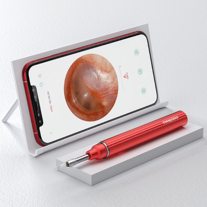 3.9mm WiFi Ohrenreiniger Ohrenschmalzentferner Ohrreinigungs-Kamera Otoskop Kabelloses LED-Licht zur oralen Inspektion für Android iOS